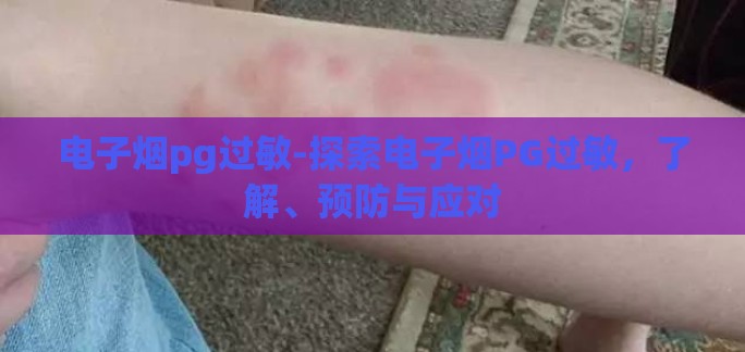 电子烟pg过敏-探索电子烟PG过敏，了解、预防与应对